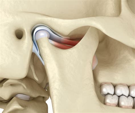 Tmj Surgery Preparation Recovery Long Term Care