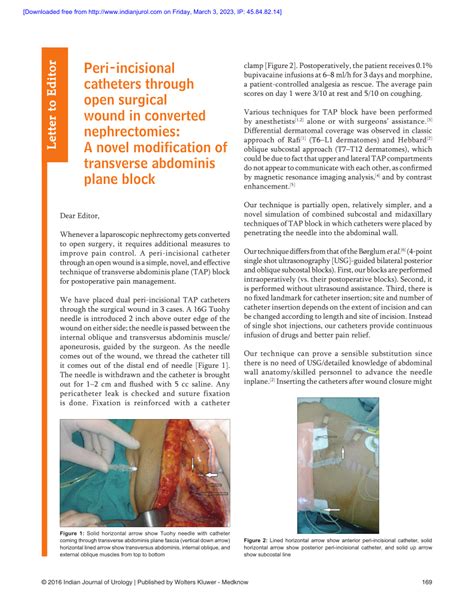 Pdf Peri Incisional Catheters Through Open Surgical Wound In