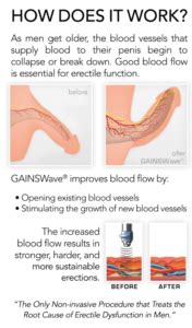 GAINSWave Activation Clinic