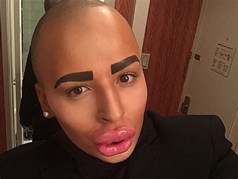British Man Drops 150k On Plastic Surgery To Look Like Kim Kardashian