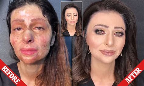 Burn Victim Gets Makeover That Brings Her To Tears Daily Mail Online