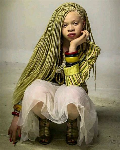 Pin By Asma Robert On Haircut African Hair Styles Albino Girl