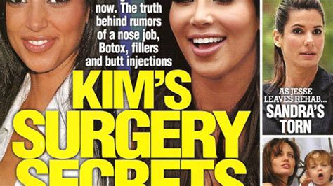 This Week In Tabloids Everyone You Think Is Pretty Had Plastic Surgery