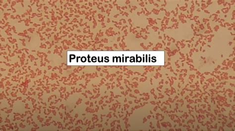 Gram Negative Rods Of Proteus Mirabilis Youtube