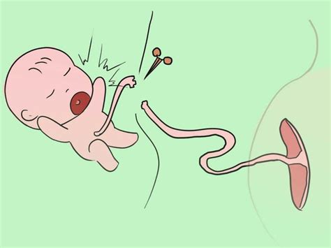 新生宝宝肚脐，该如何正确护理