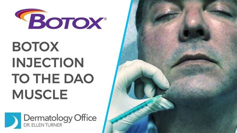 The Dao Muscle Botox® Injections In Dallas Youtube