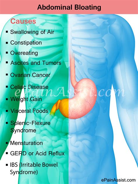 Abdominal Bloating Home Remedies And Prevention Tips