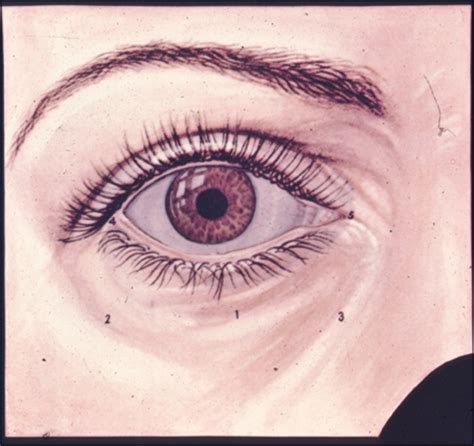 Ocular Anatomy Eyelids And Eyebrow Flashcards Quizlet