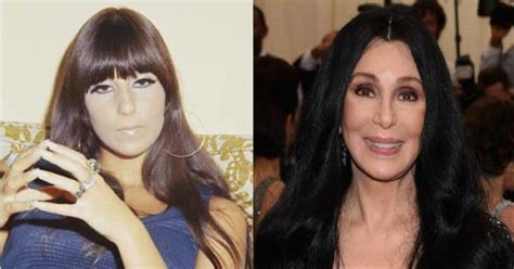 Cher Plastic Surgery Breasts Augmentation Nose Job Facelift