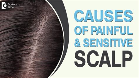 Burning Scalp And Hair Loss Causes