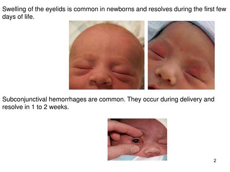 Ppt Physical Examination Of Newborn By Dr Behzad Barekatain Md