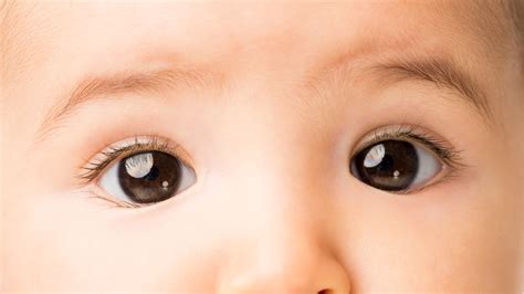 Mata Juling Pada Bayi Usia Di Bawah Empat Normalkah