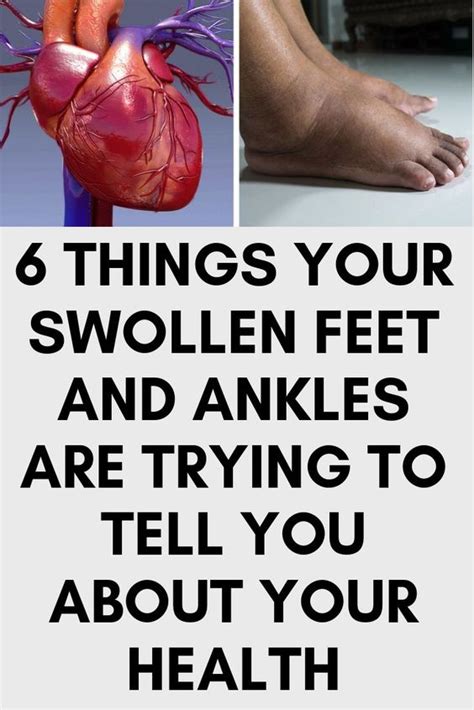 Pregnancy Symptoms Include Swollen Feet Pregnancy Sympthom