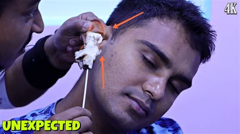 Unwanted Hair Removal From Ear And Neck Fire Method Head Massage With