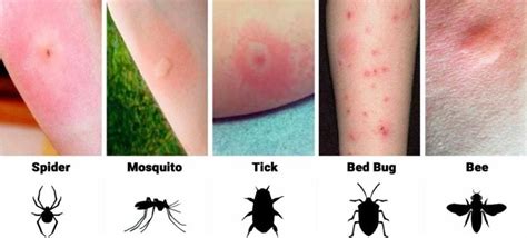 Different Types Of Bug Bites Marks Pot And Plant