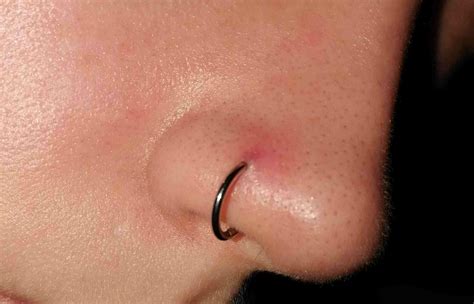 The Best Way To Treat Infected Nose Piercing 2023