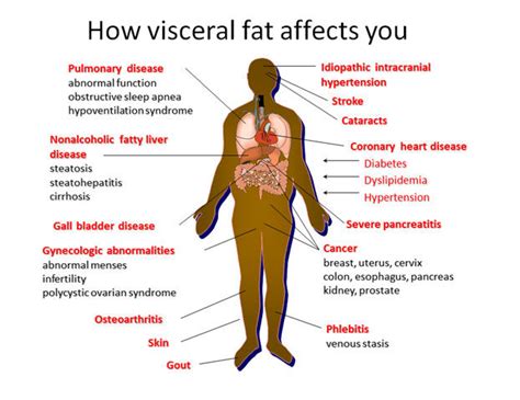 Visceral Fat