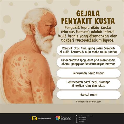 Infografis Gejala Penyakit Kusta Free Hot Nude Porn Pic Gallery