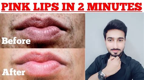 How To Get Pink Lips Naturally For Boys Get Permanent Pink Lips Youtube