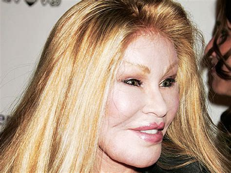 Celebrity Plastic Surgery Disasters Photo 1 Pictures Cbs News