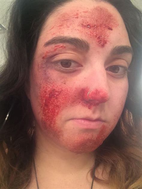 Blood And Gore Make Up Airbag Injury Stage Make Up Ideas In 2018