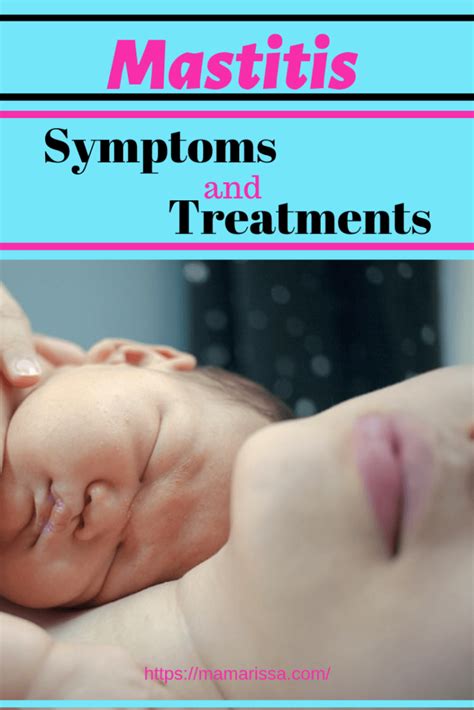 Mastitis Symptoms And Treatments Mama Rissa