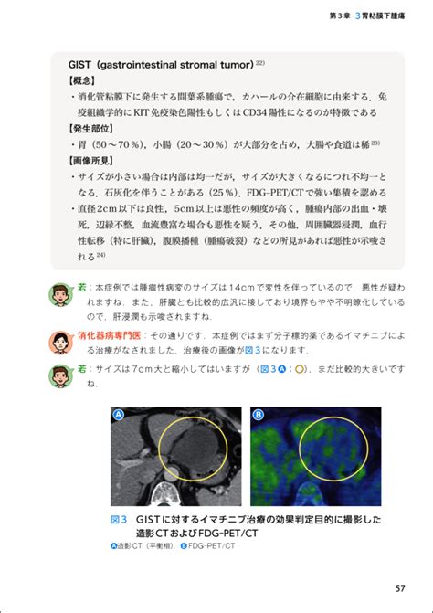 Mousou kanshou daishou renmeisimplified chinese: 癌 画像診断 本 - moji.infotiket.com