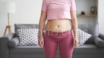 Abdominal Massage Tummy Tuck And Flabby Skin On A Fat Belly Woman