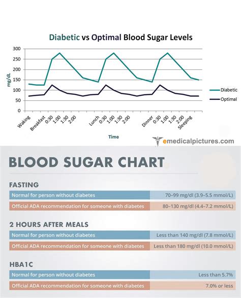Normal Blood Sugar Levels Chart Comparison With Diabetes Medical Pictures And Images