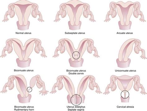 Difference Between Cervix And Uterus