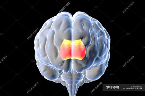 Human Brain With Highlighted Corpus Callosum Also Known As Callosal