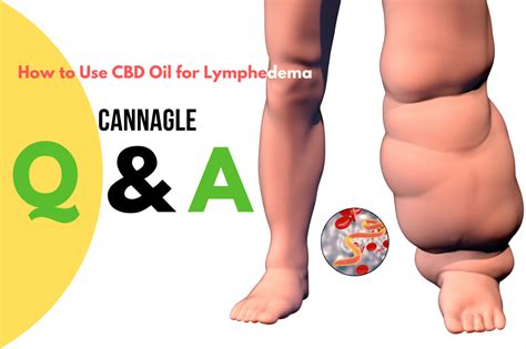How To Use Cbd Oil For Lymphedema Cannagle
