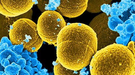 Mrsa is a staph germ (bacteria) that does not get better with the type of antibiotics that usually cure staph infections. Superbug MRSA May Be Spreading Through Contaminated ...