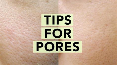 👃how To Minimize Large Pores • Skincare Solutions For Clogged Pores