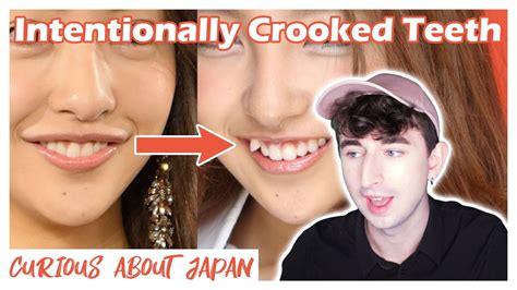 Curious About Japan Crooked Teeth Trend Yaeba Surgery Youtube