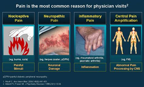 Central Sensitization National Pain Centers