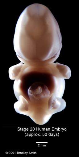 Multi Dimensional Human Embryo Stage 20 Samples
