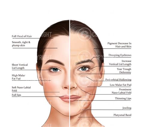 Ageing Of The Face And Neck Anatomy Poster Aesthetics
