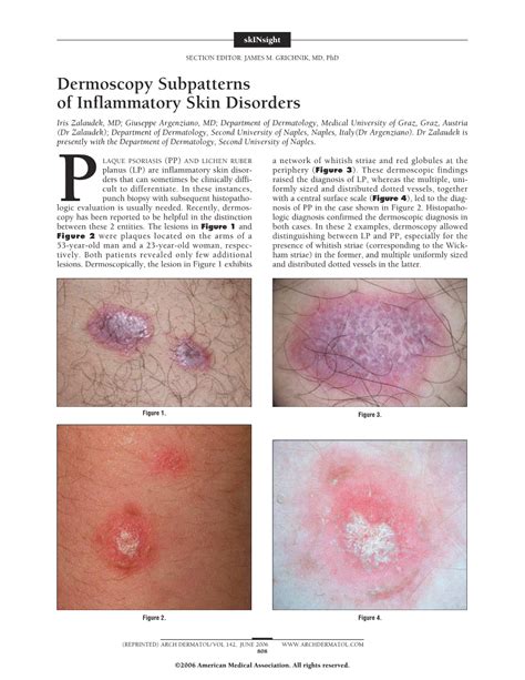 Dermoscopy Subpatterns Of Inflammatory Skin Disorders Dermatology