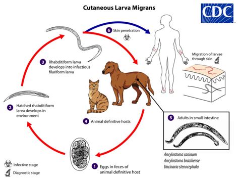 Cutaneous Larva Migrans Causes Symptoms Diagnosis Treatment And Prognosis