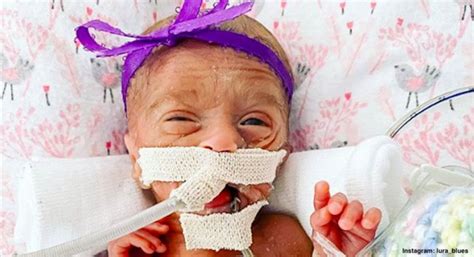 Micro Preemie Born At Weeks Survives After Parents Transfer Hospitals
