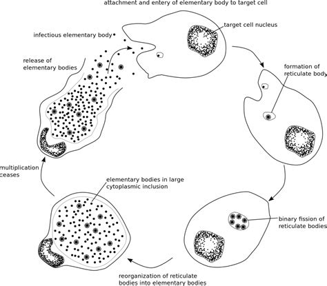 Chlamydia Clinical Features Management Teachmeobgyn