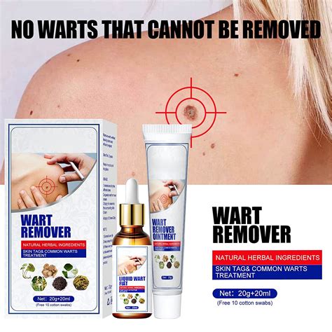 buy wart remover set wart removal ointment for common warts plantar warts molluscum eyelet