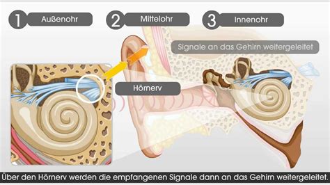 Wie Das Gehör Und Das Hören Mit Einem Cochlea Implantat Funktioniert
