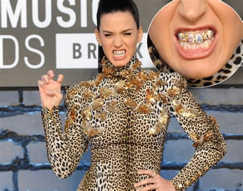 Katy Perry Flashes Grill At 2013 Vmas Celebrity Teeth Makeovers Celebrity Teeth Celebrities