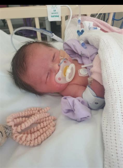 Miracle Baby Born With A Hole In Her Throat Finally Able To Go Home