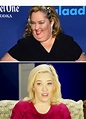 [PICS] Mama June’s Smile Makeover — Teeth In Before & After Pics ...