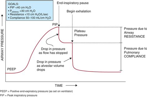 Peak Airway Pressure In Mechanical Ventilation Definition And Interpretation
