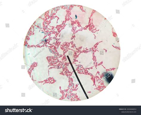 Endospore Bacillus Under Microscope 100x Bacillus Stock Photo