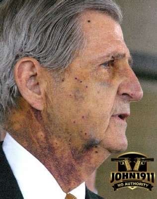 And innumerable tests conducted by the fbi, the international wound ballistics association, and various. getting-shot-birdshot-4harry-whittington-1 | John1911.com Gun Blog